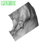 DV14-1 Homo sapiens temporal right ply