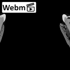 DV14-7 Homo sapiens mandible dentition ct stack movie