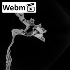 DV15-1 Homo sapiens temporal left ct stack movie