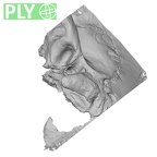 DV15-1 Homo sapiens temporal left ply