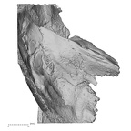 DV15-1 Homo sapiens temporal right superior