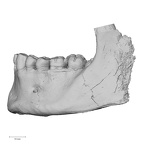 DV15-4 Homo sapiens mandible dentition lateral