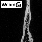 DV16-157 Homo sapiens cranium fragment ct stack movie