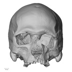 DV16-1 Homo sapiens cranium anterior