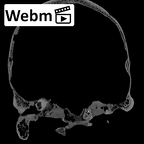 DV16-1 Homo sapiens cranium ct stack movie