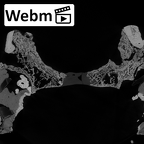 DV16-1 Homo sapiens maxilla ct stack movie