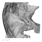 DV16-1 Homo sapiens temporal right superior