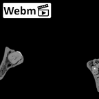 DV16-2 Homo sapiens mandible ct stack movie
