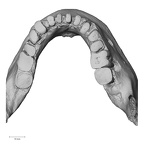 DV16-2 H. sapiens mandible dentition