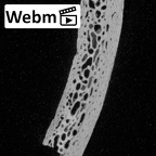 DV17-1 Homo sapiens cranium fragment ct stack movie