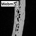 DV17-2 Homo sapiens cranium fragment ct stack movie