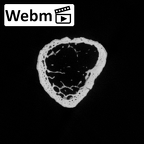 DV14-139 Homo sapiens metatarsal first right ct stack movie