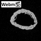 DV14-141 Homo sapiens metatarsal second right ct stack movie