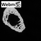 DV14-143 Homo sapiens metatarsal third right ct stack movie
