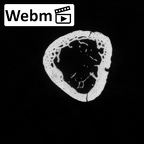 DV15-137 Homo sapiens metatarsal first left ct stack movie