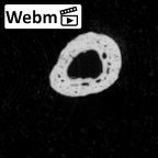 DV15-145 Homo sapiens foot phalanx third proximal right ct stack movie