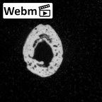 DV15-146 Homo sapiens foot phalanx fifth proximal right ct stack movie
