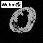 DV16-137 Homo sapiens metatarsal first left ct stack movie