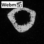 DV16-139 Homo sapiens metatarsal second left ct stack movie