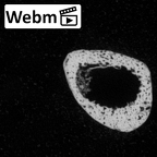 DV16-141 Homo sapiens metatarsal third left ct stack movie