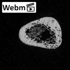 DV16-143 Homo sapiens metatarsal fourth left ct stack movie