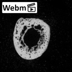 DV16-147 Homo sapiens foot phalanx second proximal right ct stack movie