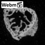 DV16-154 Homo sapiens foot phalanx fourth distal right ct stack movie