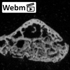 DV16-155 Homo sapiens foot phalanx fifth distal right ct stack movie