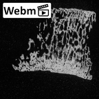 DV39 Homo sapiens navicular right ct stack movie