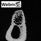DV47 Homo sapiens metatarsal third right ct stack movie