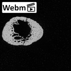 DV49 Homo sapiens metatarsal fifth right ct stack movie