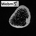 DV52 Homo sapiens foot phalanx first proximal left ct stack movie