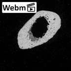 DV63 Homo sapiens metatarsal third left ct stack movie