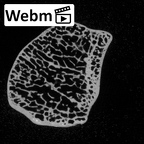 DV14-113 Homo sapiens lunate left ct stack movie