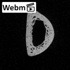 DV14-119 Homo sapiens hand phalanx third proximal right ct stack movie