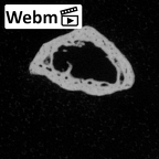DV14-121 Homo sapiens hand phalanx fifth proximal ct stack movie