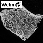 DV14-UNKNOWN Homo sapiens pisiform ct stack movie