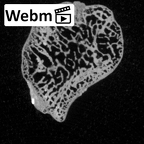 DV15-104 Homo sapiens lunate right ct stack movie