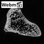 DV15-107 Homo sapiens hamate right ct stack movie