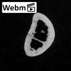 DV15-112 Homo sapiens hand phalanx second proximal right ct stack movie