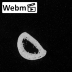 DV15-113 Homo sapiens hand phalanx third proximal left ct stack movie