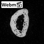 DV15-114 Homo sapiens hand phalanx fifth proximal right ct stack movie