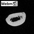 DV15-116 Homo sapiens hand phalanx third middle left ct stack movie