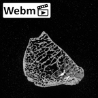 DV16-69 Homo sapiens trapezium right ct stack movie