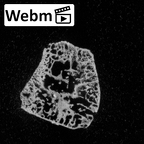 DV16-70 Homo sapiens trapezoid right ct stack movie