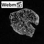 DV16-71 Homo sapiens capitate right ct stack movie