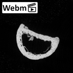 DV16-89 Homo sapiens hand phalanx third proximal left ct stack movie