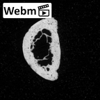 DV16-90 Homo sapiens hand phalanx fourth proximal right ct stack movie