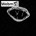 DV16-99 Homo sapiens hand phalanx first distal right ct stack movie