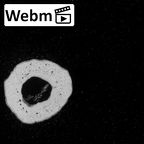 DV59 Homo sapiens metacarpal second left ct stack movie